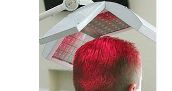 laser hair loss treatment therapy virginia washdc