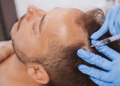 PRP Hair Therapy Transplants Washington DC