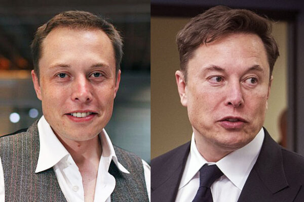 elon musk hair transplant transformation wikimedia commons